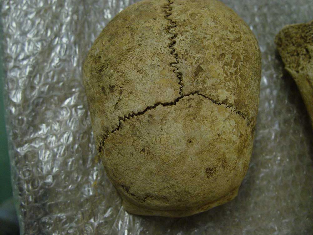 Cranial Suture Closure: useful guide or distraction? - World Archaeology